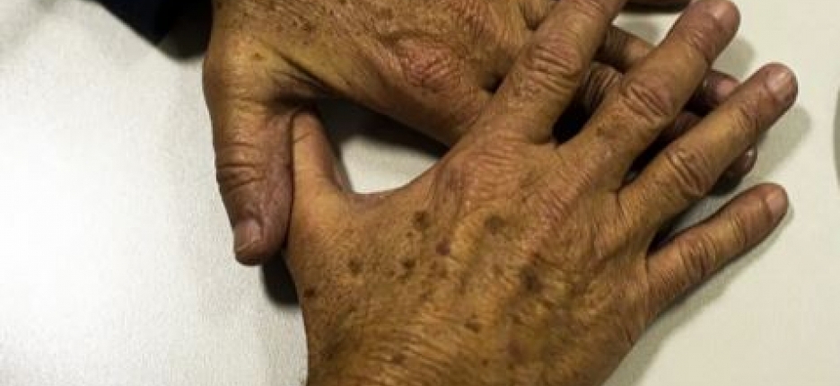 Brasil projeta 781 mil novos casos de c�ncer por ano at� 2028